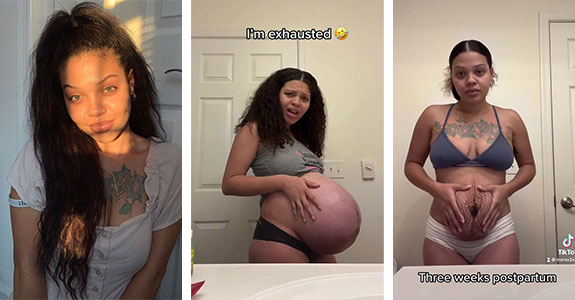 TikTok Mom Exposes Her Postpartum Journey To Combat Unrealistic Depictions Of Post-Pregnancy Bodies